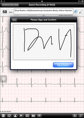 Mobile Wireless ECG Machine Portable iPad ECG Heart Rate Monitor
