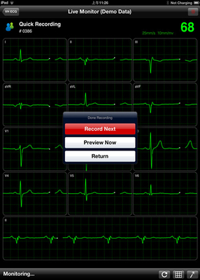 Mobile Wireless ECG Machine Portable iPad ECG Heart Rate Monitor